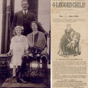 Myrtle Corbinová se vdala a se svým manželem Jamesem Clintonem Bicknellem měla pět dětí. A to i přesto, že jí lékaři nedávali prakticky žádnou naději na normální život. Narodila se totiž se dvěma páry nohou. Kromě toho měla zdvojené i pohlavní orgány...