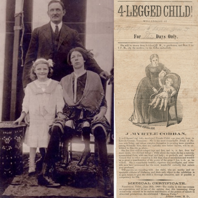 Myrtle Corbinová se vdala a se svým manželem Jamesem Clintonem Bicknellem měla pět dětí. A to i přesto, že jí lékaři nedávali prakticky žádnou naději na normální život. Narodila se totiž se dvěma páry nohou. Kromě toho měla zdvojené i pohlavní orgány...