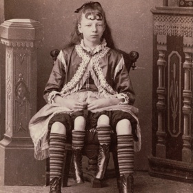 Myrtle Corbinová se dožila 59 let a rodina nechala rakev zajistit proti krádeži nejlepším možným způsobem – zalitím betonem. O tělo totiž měli zájem nejen lékaři, ale i sběratelé kuriozit.