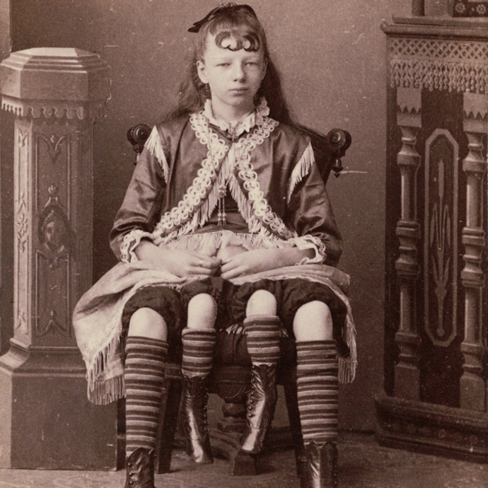 Myrtle Corbinová se dožila 59 let a rodina nechala rakev zajistit proti krádeži nejlepším možným způsobem – zalitím betonem. O tělo totiž měli zájem nejen lékaři, ale i sběratelé kuriozit.