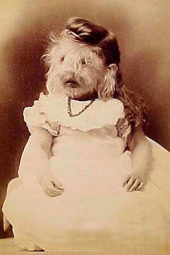 Maličká Alice Doherty musela budit hrůzu. Která matka by se chtěla smířit s takovým postižením svého dítěte? 