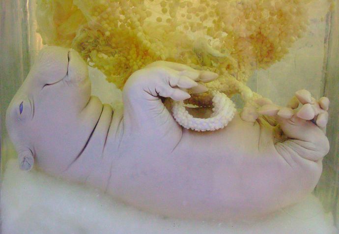 A takto vypadá nenarozený plod.