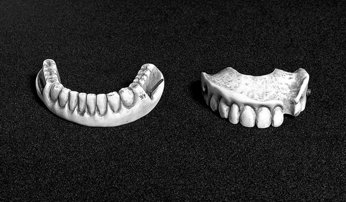 Zubní náhrady se v osmnáctém století vyráběly ze skutečných zubů. Mrtvým vojákům je vytrhávali zloději, kteří je poté prodávali lékařům. 