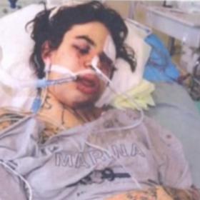 Nela Moravcová v nemocnici po brutálním útoku. Měla zlomenou horní i dolní čelist a také jazylku, kvůli čemuž jí hrozilo udušení.