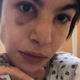 Nela Moravcová v nemocnici před propuštěním do domácího léčení.