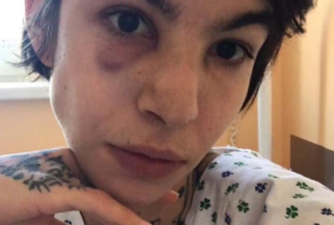 Autentické foto Nely Moravcové v nemocnici před propuštěním do domácího léčení