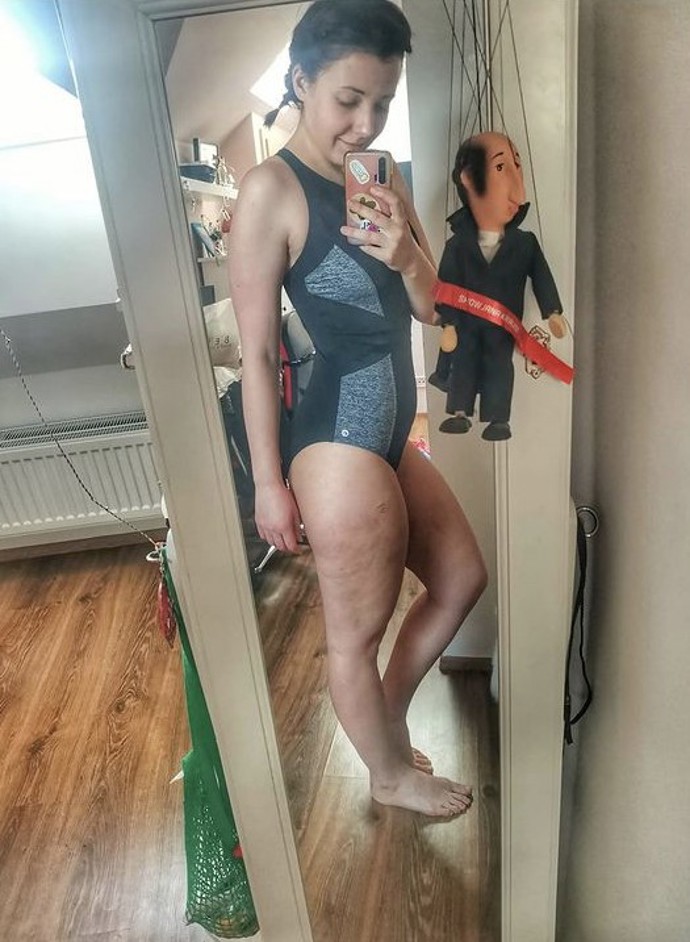 Dnes se Anna Slováčková snaží na svých sociálních sítích bojovat za běžné ženy a také propaguje prevenci.