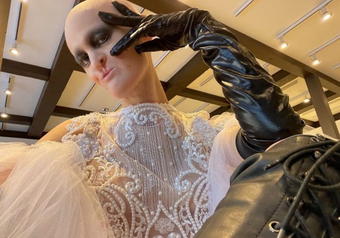 Melanie Gaydos, modelka s ektodermální dysplazií