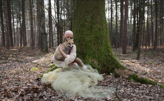 Melanie Gaydos, modelka s ektodermální dysplazií