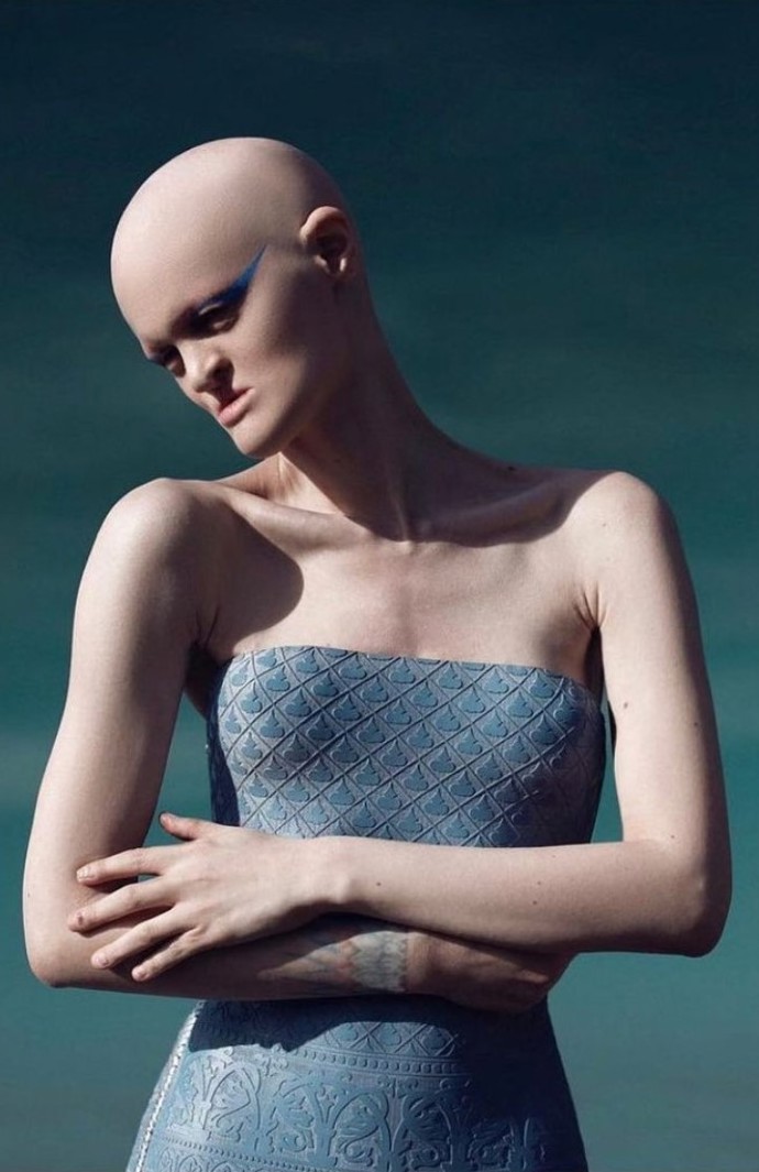 Melanie Gaydos, modelka s ektodermální dysplazií