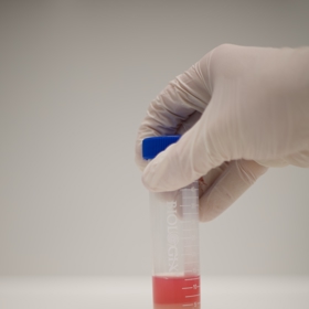 Po dostudování gymnázia plánuje Kateřina Marešová nastoupit na Přírodovědeckou fakultu Univerzity Karlovy a zabývat se odvětvím, které by souviselo s její odborností a zároveň řešilo globální problémy současnosti.