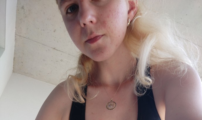 Podobně jako v případě alopecie nebo atopického ekzému, trpí při akné vaše sebevědomí i psychická pohoda.