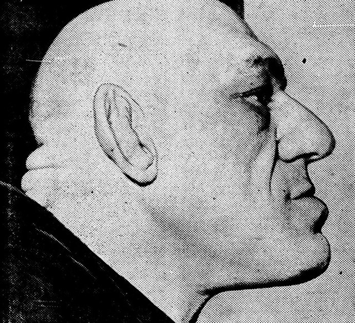 V 17 letech si Maurice Tillet všiml, že mu otékají nohy, ruce a hlava. Po návštěvě lékaře mu byla diagnostikována akromegalie, čili nadměrný růst a ztluštění kostí. 