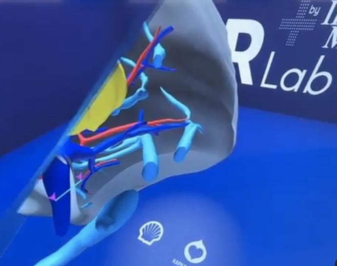 Virtuální realita se používá zejména v předoperační přípravě. Brýle pro ni ale mají chirurgové k dispozici i na sále. Tato technologie hraje důležitou roli především u složitých operací a transplantací jater u dospělých i dětí.
