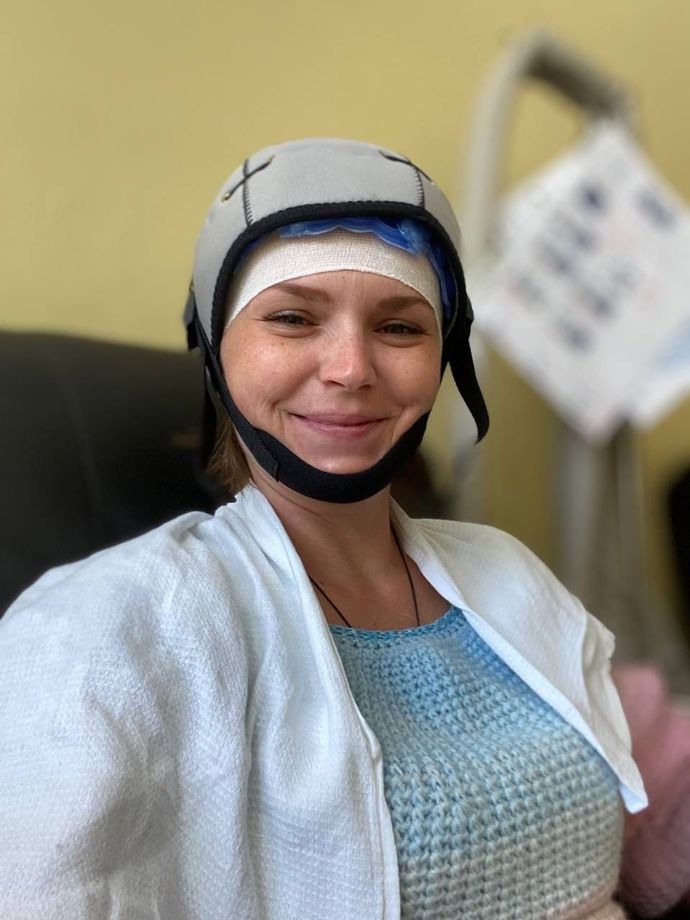 Hanka se rozhodla pro první dvě chemoterapie použít chladicí čepičku, jakousi prevenci vypadávání vlasů. Před aplikací čepičky bylo třeba vlasy namočit a po jejím nasazení ochladit pokožku hlavy na 3-5 stupňů.