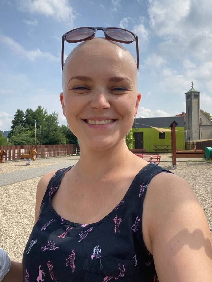 Hanka měla původně představu, že bude hrdě chodit s holou hlavou, vždyť se nemá za co stydět. Nakonec ale pochopila, že to není až takový med, hlavně po praktické stránce. "Shodit komplet vlasy a začít chodit s holou hlavu je asi stejné, jako byste žili na severním pólu, kde jste zachumlaní do kožešiny a je vám teplíčko, a najednou vyjdete ven jen ve spodním prádle. Rozdíl pocítíte ihned," poukazuje. Snímek pochází z Hančina prvního dne bez vlasů.