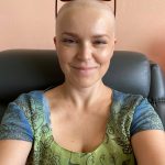 Vzdor všem opatřením Hanka postupně přišla o vlasy, řasy i obočí. Nijak těžce to ale nenesla, spíš ji některé aspekty vypadávání vlasů poněkud zaskočily. Více o tomto tématu se dovíte v jednom z dalších dílů jejího vyprávění.