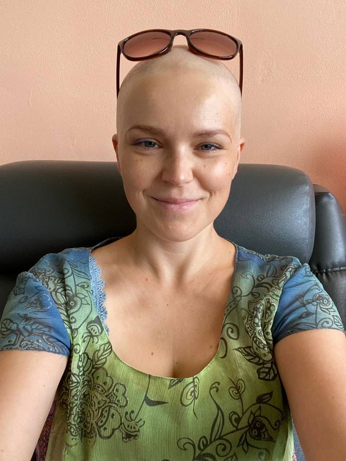 Vzdor všem opatřením Hanka postupně přišla o vlasy, řasy i obočí. Nijak těžce to ale nenesla, spíš ji některé aspekty vypadávání vlasů poněkud zaskočily. Více o tomto tématu se dovíte v jednom z dalších dílů jejího vyprávění.