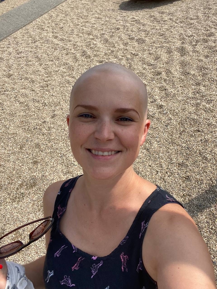 Hančin první den bez vlasů. Byl zrovna konec června a mladá maminka za sebou měla druhou dávku chemoterapie. "Milovala jsem to. Mít holou hlavu je úžasný pocit," svěřila se Hanka Samsonova.