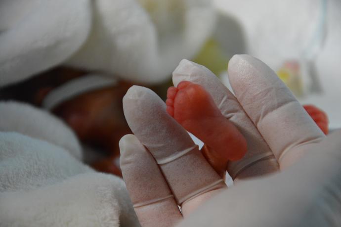 Před třemi lety zde bojovali o život dvojčátek-chlapečků paní Ivy, kteří se narodili císařským řezem ve 24. týdnu těhotenství. Jeden vážil 590, jeho bráška pak 690 gramů.