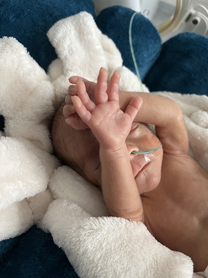 „Miminko je od nás z Ústavu pro péči o matku a dítě propuštěno domů s individuálním plánem dlouhodobého sledování u mnoha specialistů. Předčasně narozené děti si totiž nesou do života i rizika dlouhodobé nemocnosti či poruch vývoje,“ vysvětluje MUDr. Zuzana Staníčková.