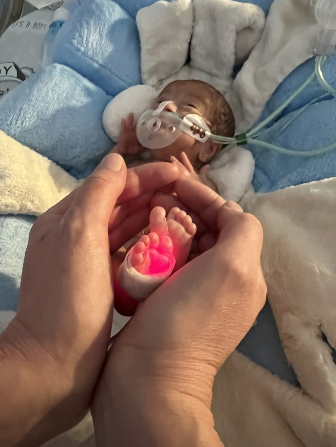 Každý rok se v České republice předčasně narodí kolem sedmi procent dětí. Zhruba 500 z nich má přitom porodní váhu pod hranicí jednoho kilogramu.