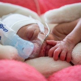 Tato děťátka patří spolu s extrémně nezralými novorozenci narozenými před 28. týdnem těhotenství mezi nejkřehčí miminka a jsou ohrožena celou řadou vážných komplikací.