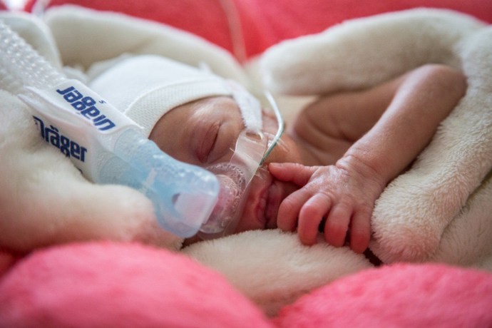 Tato děťátka patří spolu s extrémně nezralými novorozenci narozenými před 28. týdnem těhotenství mezi nejkřehčí miminka a jsou ohrožena celou řadou vážných komplikací.