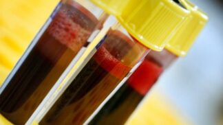 Zhubněte podle krevní skupiny. Stačí mít ten správný jídelníček!