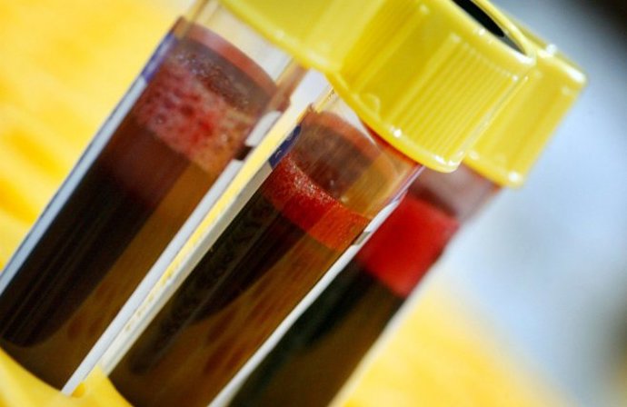 Zhubněte podle krevní skupiny. Stačí mít ten správný jídelníček!