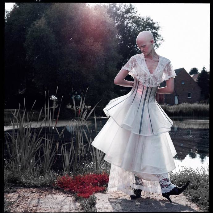 Melanie Gaydos své postižení využila jako přednost