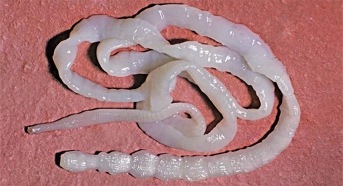 Lidé polykali tasemnice ve velkém.