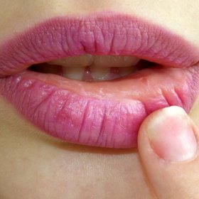 Afty pálí a jsou velmi nepříjemné.