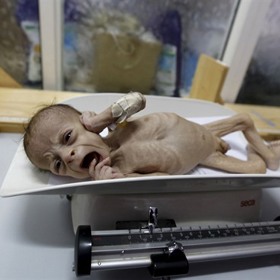 Takhle tam vypadají běžně podvyživená miminka