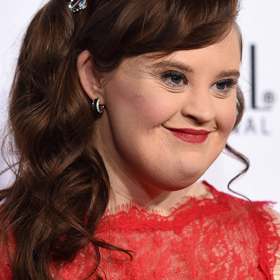 6. Jamie Brewer. Exceluje v seriálu American Horror Story přesto, že se narodila s Downovým syndromem.