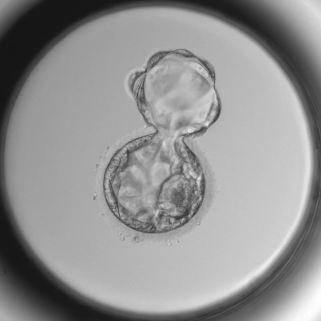 Embryo Embryo