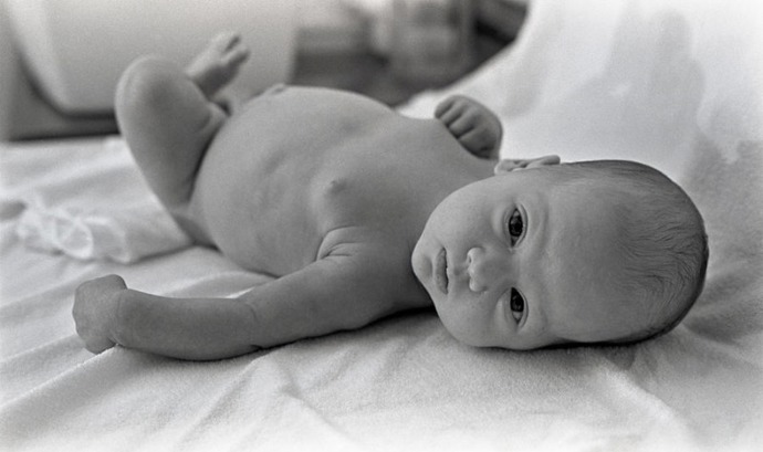 Přebalování, na fotografii zhruba čtyři měsíce stará Alison.
Zdroj: www.jackradcliffe.org