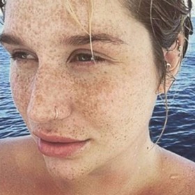 Kesha