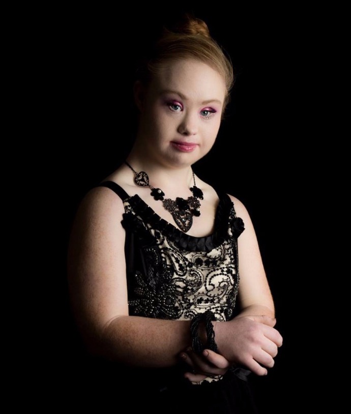 Teenagerka s Downovým syndromem uzavřela kontrakt s modelingovou agenturou Teenagerka s Downovým syndromem uzavřela kontrakt s modelingovou agenturou