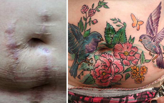 Tato umělkyně mění jizvy v něco krásného Tato umělkyně mění jizvy v něco krásného