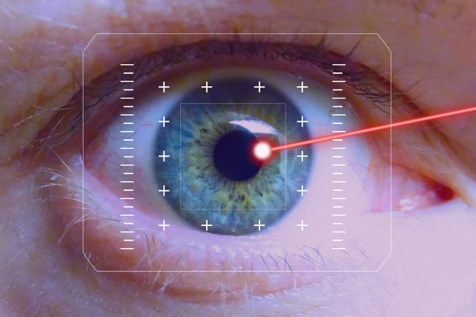 5. Laserové operace jsou bolestivé - MÝTUS
V průběhu zákroku je bezbolestná každá metoda. Otázka bolestivosti nastává až v průběhu hojení. Povrchové laserové metody (PRK, Lasek, epi-LASEK, Super Laser, No Touch, Laser, 6D Laser), při kterých chirurg odstraňuje povrch rohovky, způsobuje výraznější stupeň bolesti. První tři dny po zákroku epitel dorůstá a tento moment je pro pacienta bolestivý. Při nejmodernějších laserových zákrocích s použitím femtosekundového laseru pacient po zákroku žádnou bolest necítí. Už večer v den operace může číst a sledovat televizi a druhý den pohodlně pracovat.
5. Laserové operace jsou bolestivé - MÝTUS
V průběhu zákroku je bezbolestná každá metoda. Otázka bolestivosti nastává až v průběhu hojení. Povrchové laserové metody (PRK, Lasek, epi-LASEK, Super Laser, No Touch, Laser, 6D Laser), při kterých chirurg odstraňuje povrch rohovky, způsobuje výraznější stupeň bolesti. První tři dny po zákroku epitel dorůstá a tento moment je pro pacienta bolestivý. Při nejmodernějších laserových zákrocích s použitím femtosekundového laseru pacient po zákroku žádnou bolest necítí. Už večer v den operace může číst a sledovat televizi a druhý den pohodlně pracovat.