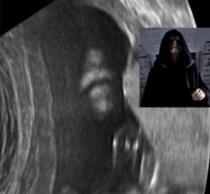Temná strana síly aneb Když ultrazvuk vypadá jako Darth Sidious z Hvězdných válek. 

