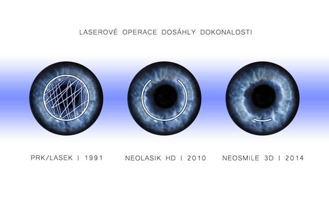 LASEROVEOPERACEDOSAHLIDOKONALOSTI_copy