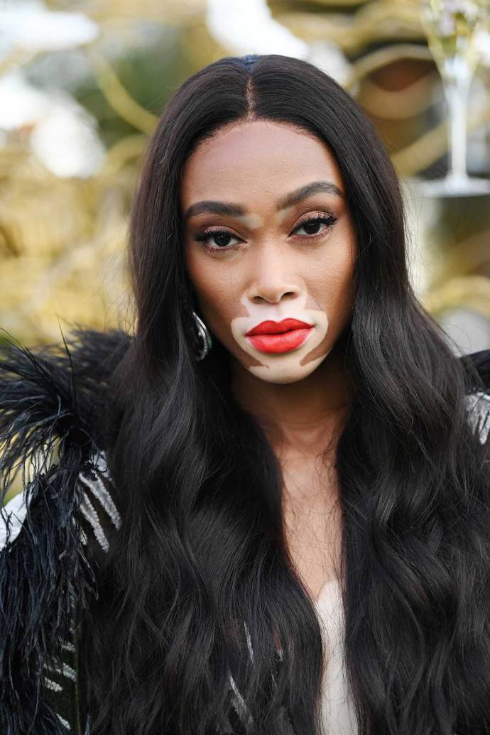 Winnie Harlow
"Snažím se si na pleť nedávat moc různých produktů. Když mám náročnější program, hodně používám pleťové masky. Na každodenní čistění používám africké černé mýdlo - je krásně čisté a udržuje mou pleť svěží. Potom si nanáším směs vody a tea tree oleje. Také si chci být jistá tím, že vše, co používám, je hypoalergenní a přírodní. Miluji Skin Recovery Cream od Eau Thermale Avène. Je to jediný krém, který kompletně zklidní mou pleť."
Winnie Harlow
"Snažím se si na pleť nedávat moc různých produktů. Když mám náročnější program, hodně používám pleťové masky. Na každodenní čistění používám africké černé mýdlo - je krásně čisté a udržuje mou pleť svěží. Potom si nanáším směs vody a tea tree oleje. Také si chci být jistá tím, že vše, co používám, je hypoalergenní a přírodní. Miluji Skin Recovery Cream od Eau Thermale Avène. Je to jediný krém, který kompletně zklidní mou pleť."