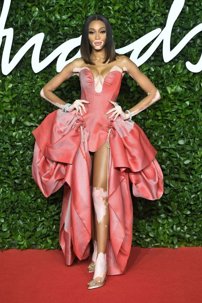 Winnie Harlow v šatech z kolekce Andreas Kronthaler for Vivienne Westwood a lodičkách Roger Vivier
Winnie Harlow v šatech z kolekce Andreas Kronthaler for Vivienne Westwood a lodičkách Roger Vivier