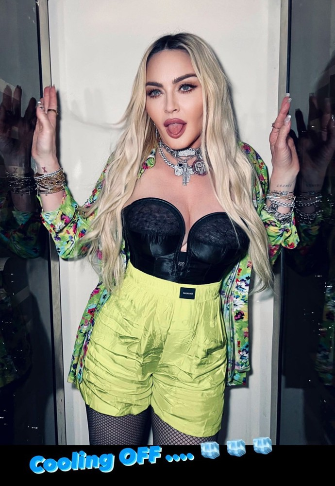 Madonna se ani v pokročilém věku plastik rozhodně nebojí. Naopak s nimi značně přitvrzuje. O přirozeném stárnutí se u zpěvačky tedy rozhodně hovořit nedá.
