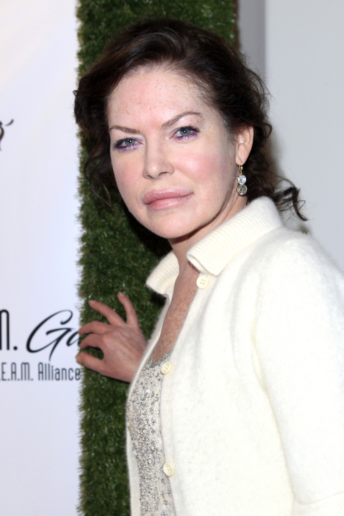 Lara Flynn Boyle je jednou z nejvýraznějších hereček devadesátých let. Tenkrát zářila v seriálu Městečko Twin Peaks a těšila se přízni tisíců fanoušků Svou přirozenou krásu ale bohužel zakryla četnými plastikami, takže zároveň ubyly nabídky na natáčení kultovních snímků. Zlý jazykové tvrdí, že se stala vlivem kosmetických úprav spíš nápodobou mimozemšťana než slavnou herečkou.
