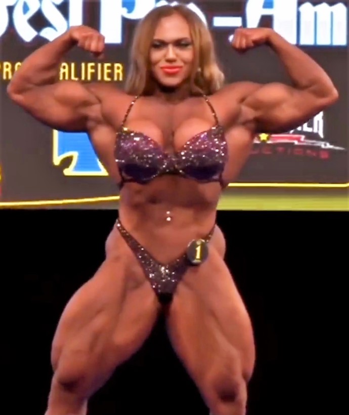 Ruská kulturistka Natalia Kuznetsova na soutěži Wings of Strength Romania Muscle Fest v roce 2018. Ke svým svalům si pomohla steroidy a blokátory estrogenu.
Ruská kulturistka Natalia Kuznetsova na soutěži Wings of Strength Romania Muscle Fest v roce 2018. Ke svým svalům si pomohla steroidy a blokátory estrogenu.