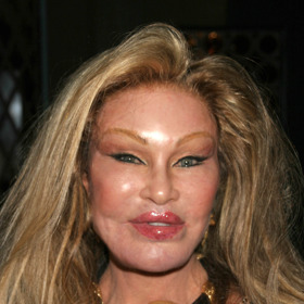 Jocelyn Wildenstein se chtěla líbit bývalému manželovi, který miloval šelmy. Dnes však "Kočičí žena" popírá, že by kdy šla "pod kudlu".
