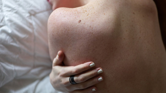 Anglická metoda, která vám pomůže odhalit, zda vaše znaménko může způsobit rakovinu kůže